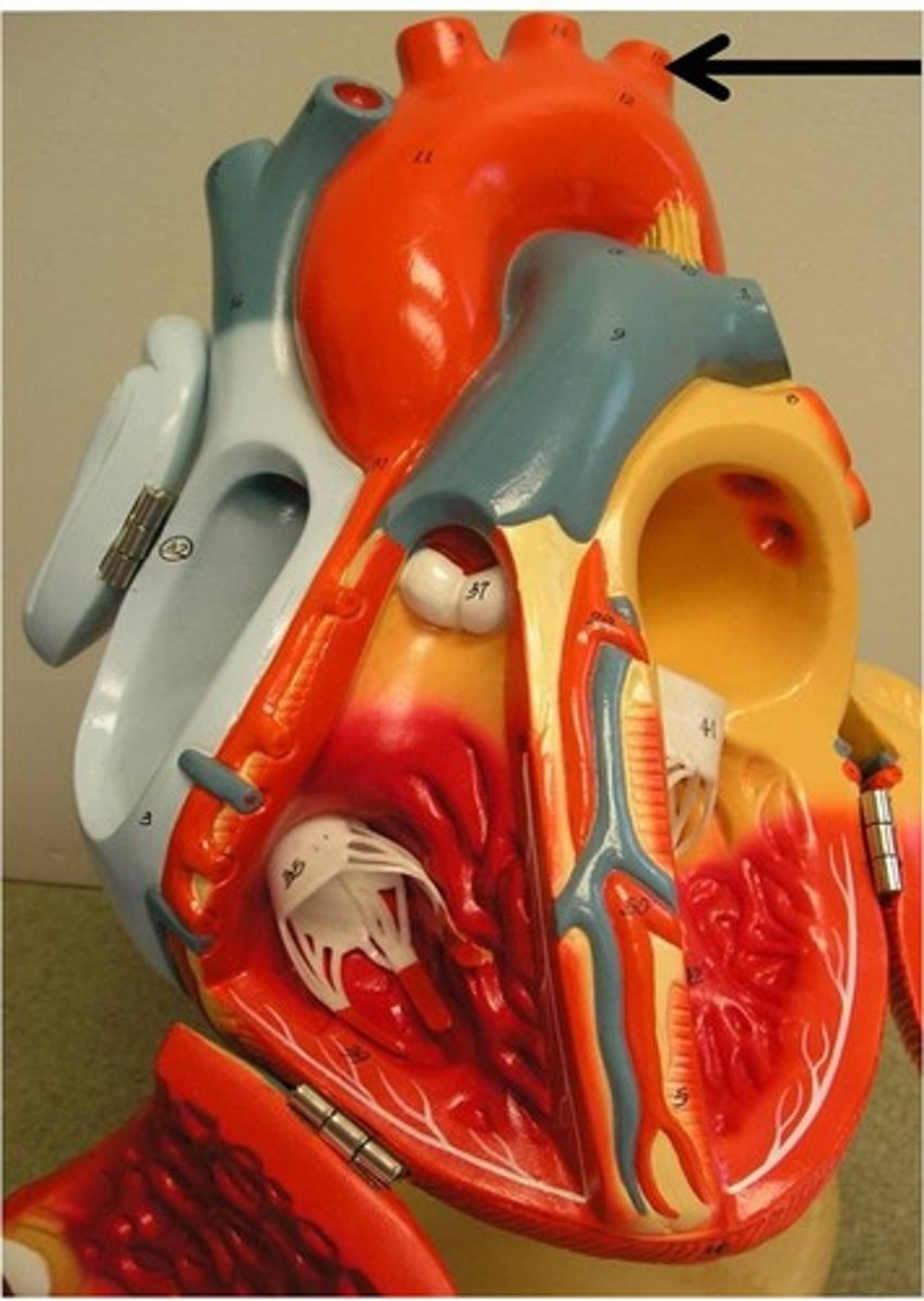 <p>left most branch off the the aortic arch</p>
