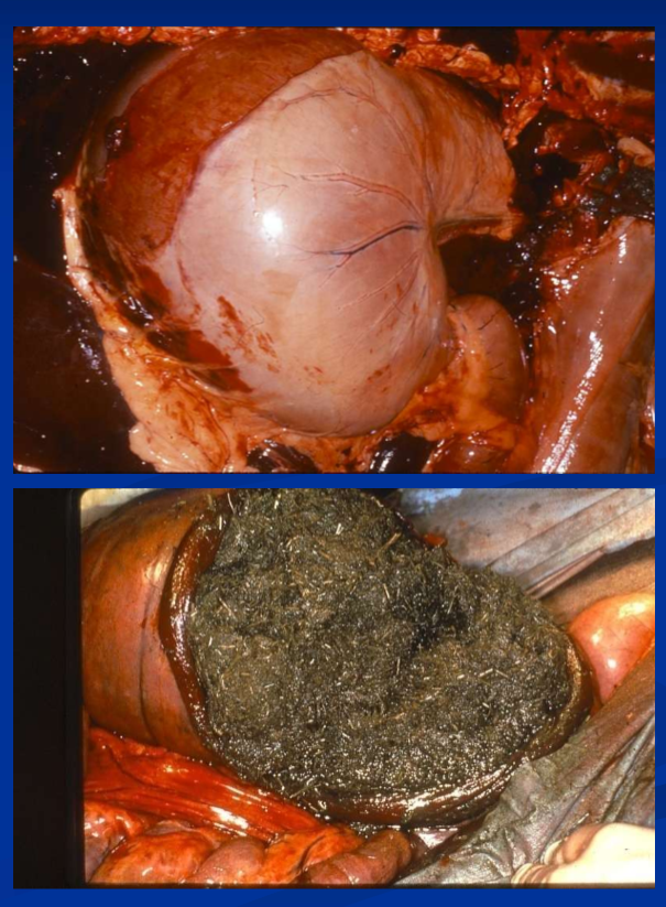 <ul><li><p><strong>abdominal ultrasound: </strong>large radius of stomach curvature and splenic displacement; gastroscopy </p></li><li><p>medical tx for impacted feed is <strong>oral hydration </strong>with crystalloid solutions </p></li><li><p>oral infusion of <strong>carbonated beverage </strong>for persimmons </p></li><li><p>may be dx-ed at <strong>exploratory laparotomy; </strong>transmural hydration and massage of mass followed by medical tx </p></li><li><p>prognosis for idiopathic impaction with gastric enlargement is guarded risk of recurrence rupture </p></li></ul><p></p>