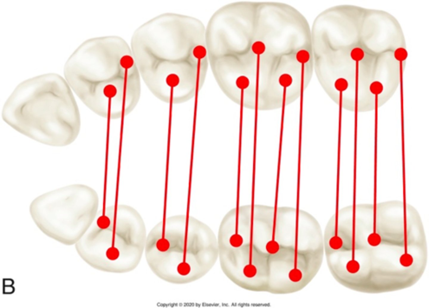 <p>ID the occlusion classification:</p>