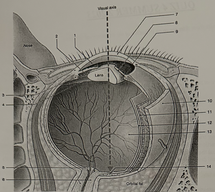 **Identify the space labeled “1.”**

a. posterior cavity

b. posterior chamber

c. pupil

d. anterior chamber

e. vitreous chamber