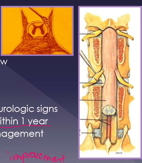 <ul><li><p>medical </p><ul><li><p>often the preferred treatment </p></li><li><p>pain medication </p><ul><li><p>Gabapentin - 10-15mg/kg TID </p></li><li><p>NSAID (carprofen, meloxicam) </p></li></ul></li><li><p>nursing /supportive care </p><ul><li><p>sling support / ambulatory assistance </p></li><li><p>padded bedding </p></li><li><p>good footing </p></li><li><p>bladder management (if needed) </p></li></ul></li></ul></li><li><p>surgical </p><ul><li><p>goals </p><ul><li><p>decompression </p></li><li><p>restoration of blood flow </p></li><li><p>axonal regeneration </p></li></ul></li><li><p>procedure </p><ul><li><p>laminectomy </p></li></ul></li><li><p>acute worsening of neurologic signs </p></li><li><p><strong>deterioration of signs within 1 year </strong></p></li><li><p>continue medical management protocol </p></li><li><p>you dont really see improvement </p></li></ul></li></ul><p></p>