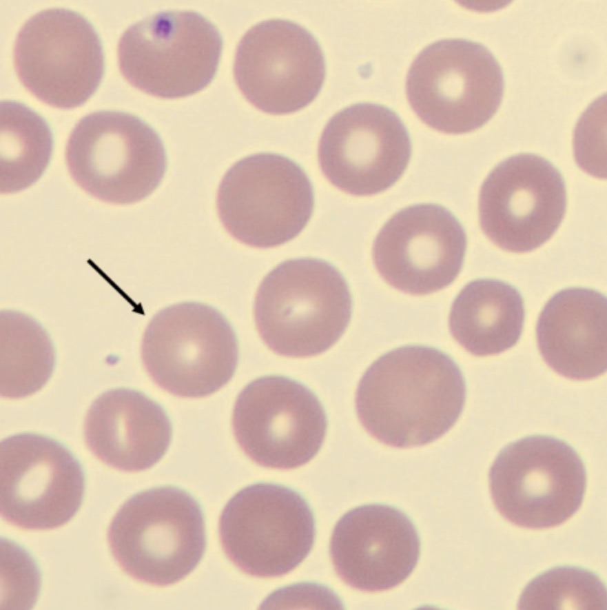 <p>What characteristic describes the size of this erythrocyte?</p>