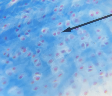 <p>what kind of cartilage is this </p>