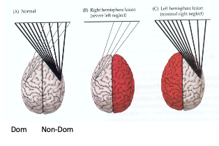<p>parietal </p>