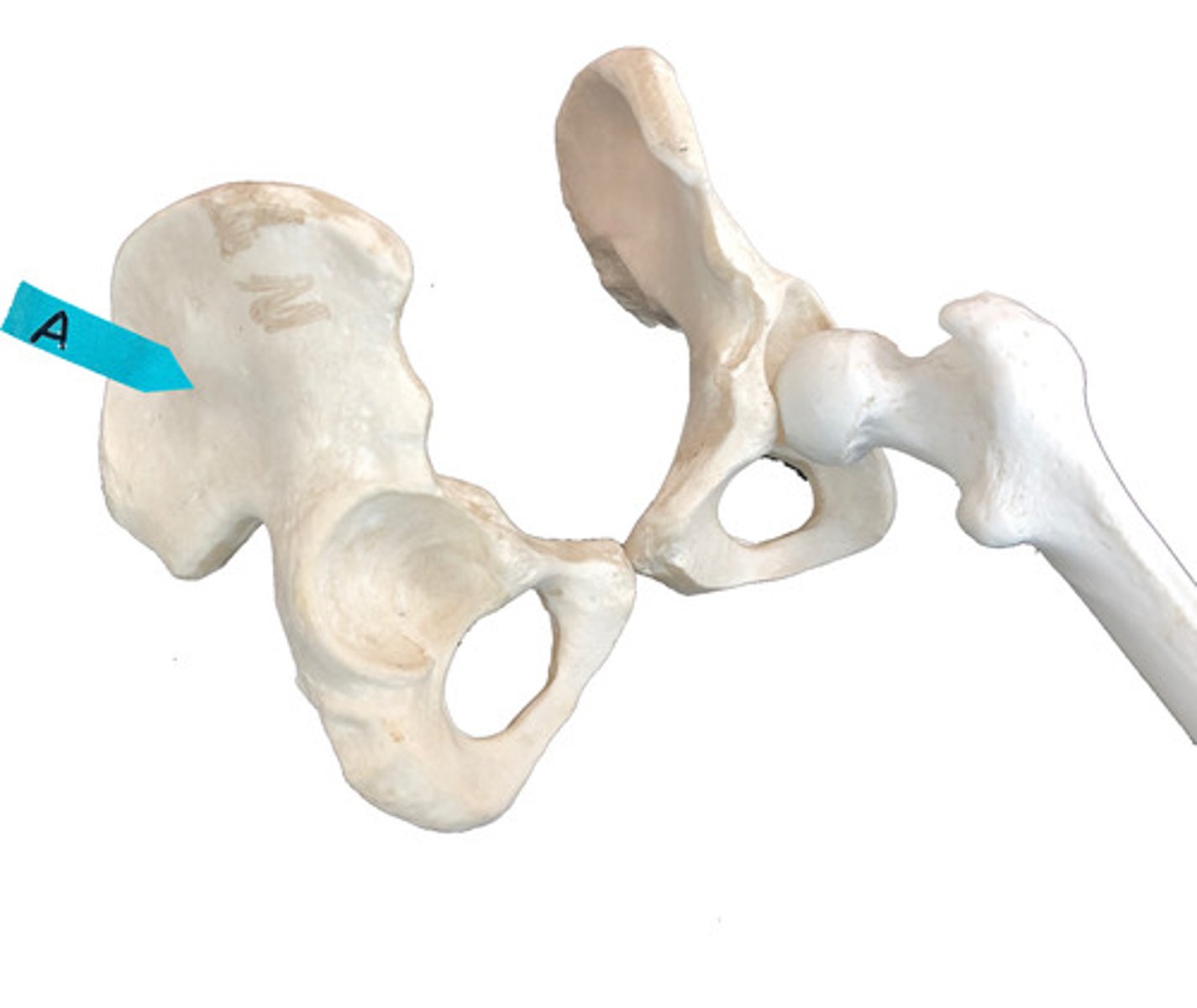 <p>Identify this bone that is one of 3 bones that fuse to form the coxal bone.</p>