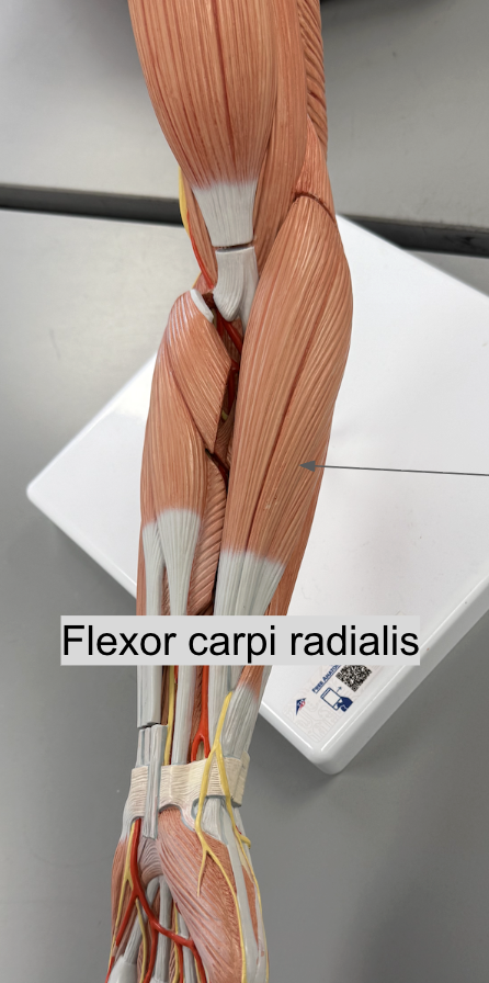 <p>muscle name & function</p>
