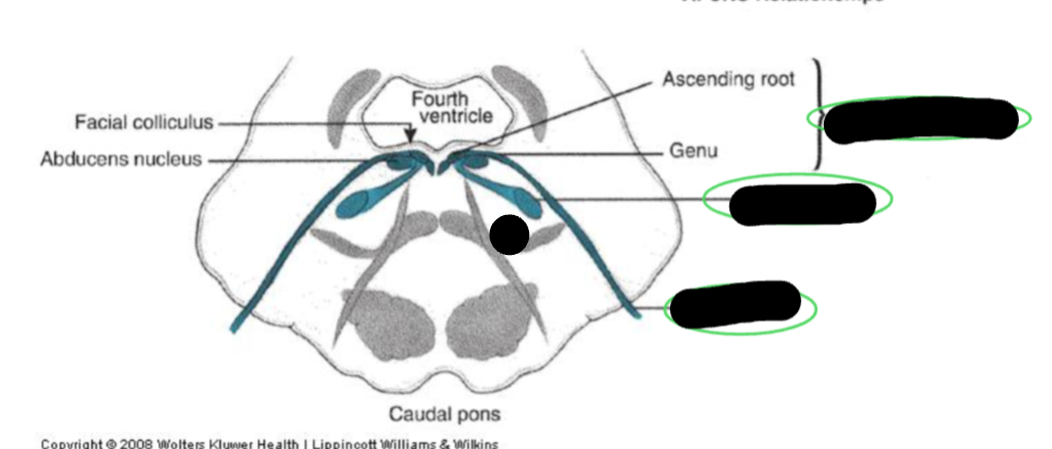 <p>what CN is the picture showing?</p>