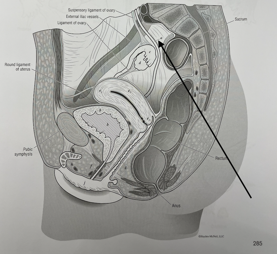 <p>what structure is this</p>