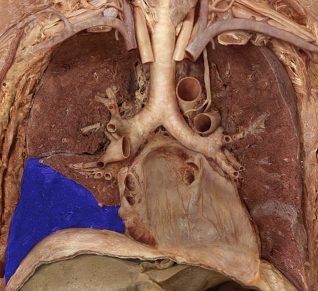<p>Label the Lung Segment</p>
