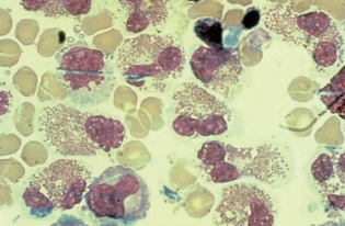 Figure 9: Eosinophils