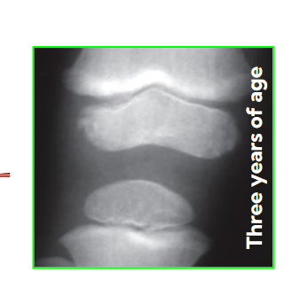<p>Epiphyseal plates </p>