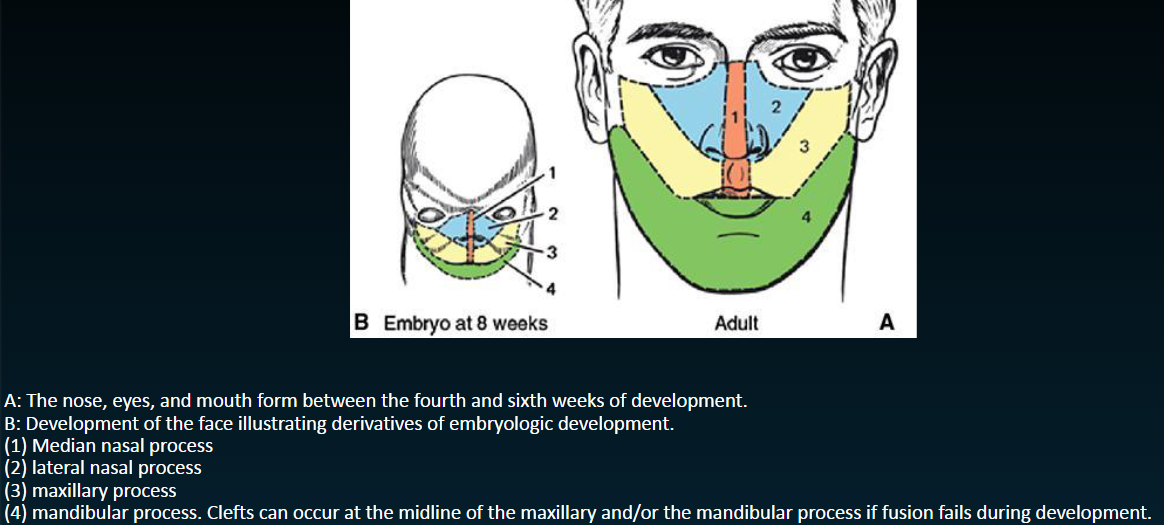 <p><span><strong>Embryology </strong></span></p><p><span><strong>• Cleft lip and palate represent a failure of normal fusion of embryonic processes during development in the first trimester of pregnancy </strong></span></p><p><span><strong>• Fusion begins in the premaxillary region and continues backward toward the uvula </strong></span></p><p><span><strong>• Formation of lip: 4th -8</strong></span><strong>th </strong><span><strong>weeks in utero, cleft apparent by end of second month </strong></span></p><p><span><strong>• Development of palate: 5th-12</strong></span><strong>th </strong><span><strong>weeks in utero, cleft apparent by end of third month </strong></span></p>