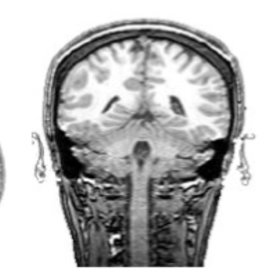 <p>what slice of brain is this?</p>