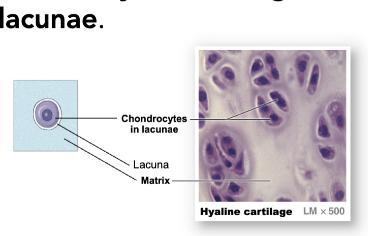 <p>both bone and cartilage are connective tissues (meaning they both have dense, solid matrix)</p><ul><li><p><strong><mark data-color="yellow" style="background-color: yellow; color: inherit"><u>bones</u></mark></strong></p><ul><li><p>their matrix (the ground substance) contains collagen, calcified and hydroxyapatite (calcium and phosphate perticpiated); more rigid</p></li><li><p>compact bone around the outside and spongy bone inside and on the ends of the bone</p><ol><li><p>compact</p><ul><li><p>always have layers and layers around central holes</p></li><li><p>lots of solid matrix with little cells in-between layers</p></li><li><p><strong>dense tissue</strong> with hallow tubes</p></li><li><p>so its COMPACT so its very good at <strong>resisting compression</strong></p></li></ul></li><li><p>spongy</p><ul><li><p>found on the inside of bone</p></li><li><p>all bones have a layer of compact bone around the outside and the inside will have hallow spaces filled with meshed work (aka. spongy bone)</p></li><li><p>doesn’t have as much tissues and matrix, so more spaces making it <strong>light</strong> and therefore can <strong>distribute forces</strong></p></li><li><p>the hallow spaces in the sponge bone contains <strong>bone marrow</strong></p><ul><li><p><strong>bone marrow</strong></p><ul><li><p>is a connective tissue but not a supportive connective tissue, instead it is where blood is created</p></li></ul></li></ul></li></ul></li></ol></li><li><p>bone tissues are highly vascularized (blood vessels running anywhere) and innervated (nerves through the bone tissue) and in the hallow spaces have bone marrow</p><ul><li><p>ex. long bone (femur)</p></li></ul></li><li><p><strong>endosteum</strong></p><ul><li><p>the space between the spongy bone</p></li><li><p>endo = inside and osteum =bone</p></li><li><p>layer of epithelia tissue lining the surface of spongy bone between the bone and bone marrow</p></li></ul></li><li><p><strong>periosteum</strong></p><ul><li><p>on the outside of bone</p></li><li><p>perio = around perimeter, another epithelia layer</p></li></ul></li><li><p>bone tissue contains many cell types with distinct roles</p><ol><li><p>osteogenics cells</p><ul><li><p>cells that create new bone tissues and bone cells (the stem cells for bones)</p></li><li><p>found in the endosteum</p></li><li><p>osteogenic cells divides then the osteoblasts lays the new bone tissues</p></li></ul></li><li><p>osteoblasts</p><ul><li><p>blast = builds</p></li></ul><ul><li><p>laying down the new bone tissues</p></li><li><p>MOST are found on the periosteum</p></li><li><p>once the osteoblasts become embedded in the bone matrix they become mature cells called osteocytes</p></li></ul></li><li><p>osteocytes</p><ul><li><p>mature bone cells</p></li><li><p>maintain bone matrix and do a little of modification but can’t lay down lots of new matrix at one time like osteoblasts</p></li><li><p>found in the bone matrix, lacunae</p></li></ul></li><li><p>osteoclasts (maintains calcium levels)</p><ul><li><p>clasts = clashes / removes bone matrix by dissolving it —&gt; can make it rapidly</p></li><li><p>breaks down bone tissue by secreting acids and enzymes that dissolve the mineralized bone matrix, which contains calcium and phosphate </p></li><li><p>and as the bone matrix is broken down, calcium is released into the blood stream which helps increase blood calcium levels when they are low </p></li><li><p>found in the endosteum</p></li></ul></li></ol></li></ul></li><li><p><strong><mark data-color="yellow" style="background-color: yellow; color: inherit"><u>cartilage (cartilage are alrd matured, bc theyre not laying down new cartilage)</u></mark></strong></p><ul><li><p>their matrix contains proteoglycans (glycoproteins which include chondroitin sulfates): more flexible, not as rigid as bone</p></li><li><p>cartilage are avascular (meaning no blood tissue)</p></li><li><p>all forms of cartilages contains cells called chondrocytes (cells responsible for cartilage formation)</p><ul><li><p>chondrocytes resides in lacunae (the little holes in the matrix)</p></li></ul></li><li><p>three subtypes of cartilage that differs in extracellular fibre composition</p><ol><li><p>hyaline cartilage</p><ul><li><p>lots of proteoglycans</p></li><li><p>will look smooth and glassy bc it absorbs water</p></li></ul><ul><li><p>found on joint surfaces</p></li></ul></li><li><p>elastic cartilage</p><ul><li><p>proteoglycans + elastin fibres</p></li><li><p>flexible and springs back and will look dark in histology</p></li></ul><ul><li><p>found in your ears and nose</p></li></ul></li><li><p>fibrocartilage</p><ul><li><p>proteoglycans + collagen fibres</p></li><li><p>not a connective tissue</p></li><li><p>found in vertebrae discs</p></li><li><p>bit more tougher, handles squishing better, not very smooth/slidy BUT ITS TUFF</p></li></ul></li></ol></li></ul></li></ul><p></p>
