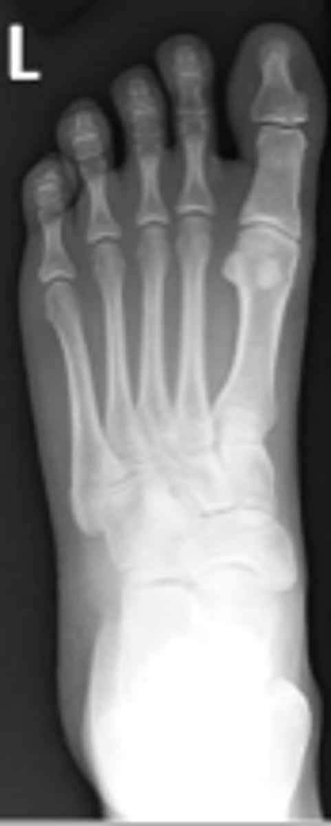 <p>What is the name of the radiographic view?</p>