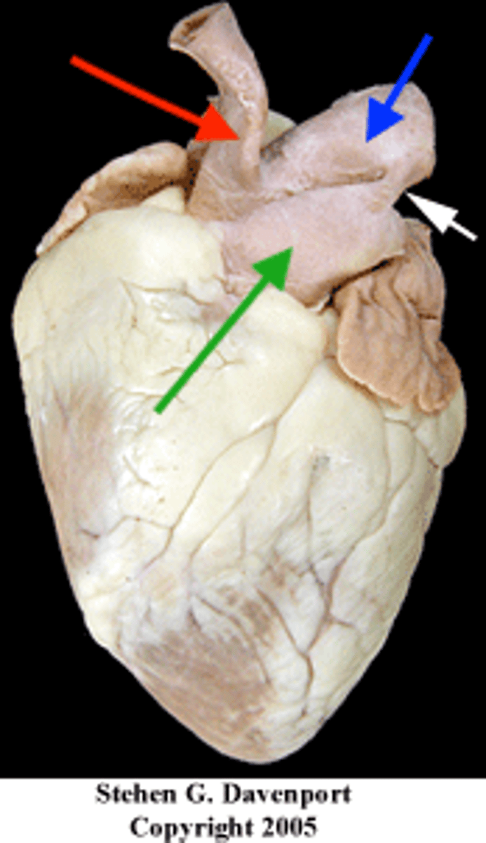 <p>Identify the red blood vessel.</p>