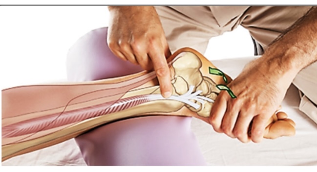 <p>tibialis posterior</p>