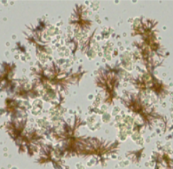 <p>name this crystal? what is it associated with? what is its ph? normal or abnormal?</p>