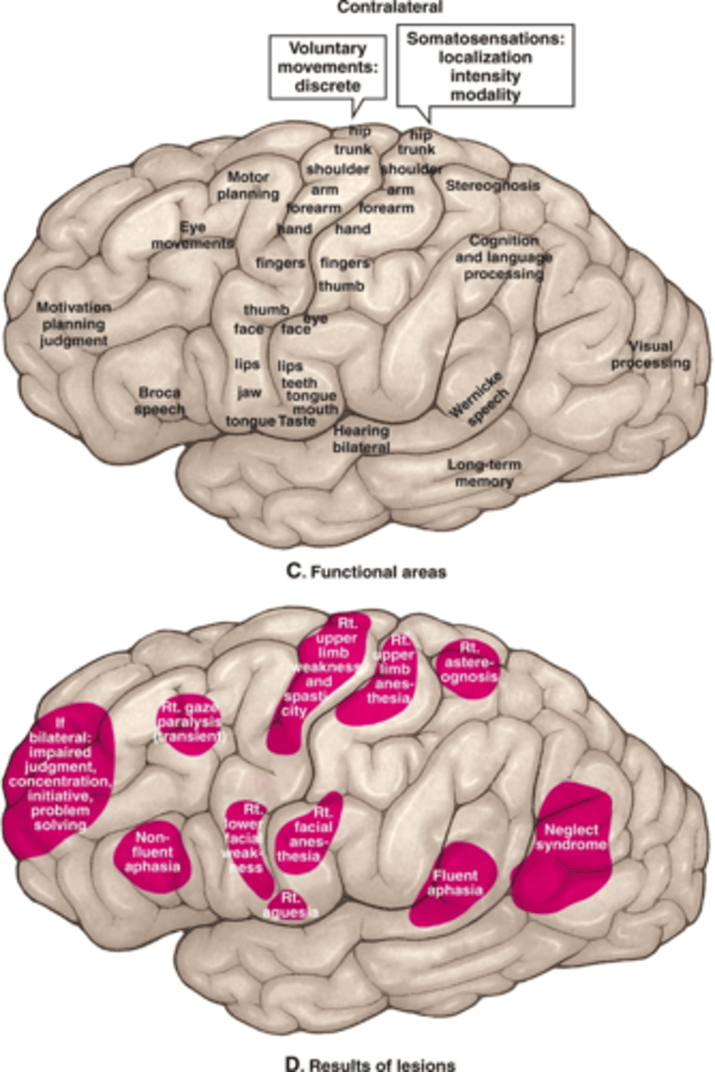 <p>Your patient has a loss of motor speech, what Brodmann's area is lesioned?</p>