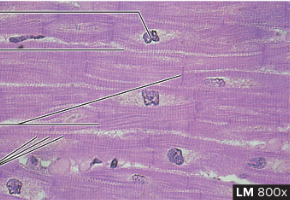 <p>what type of muscle is this</p>