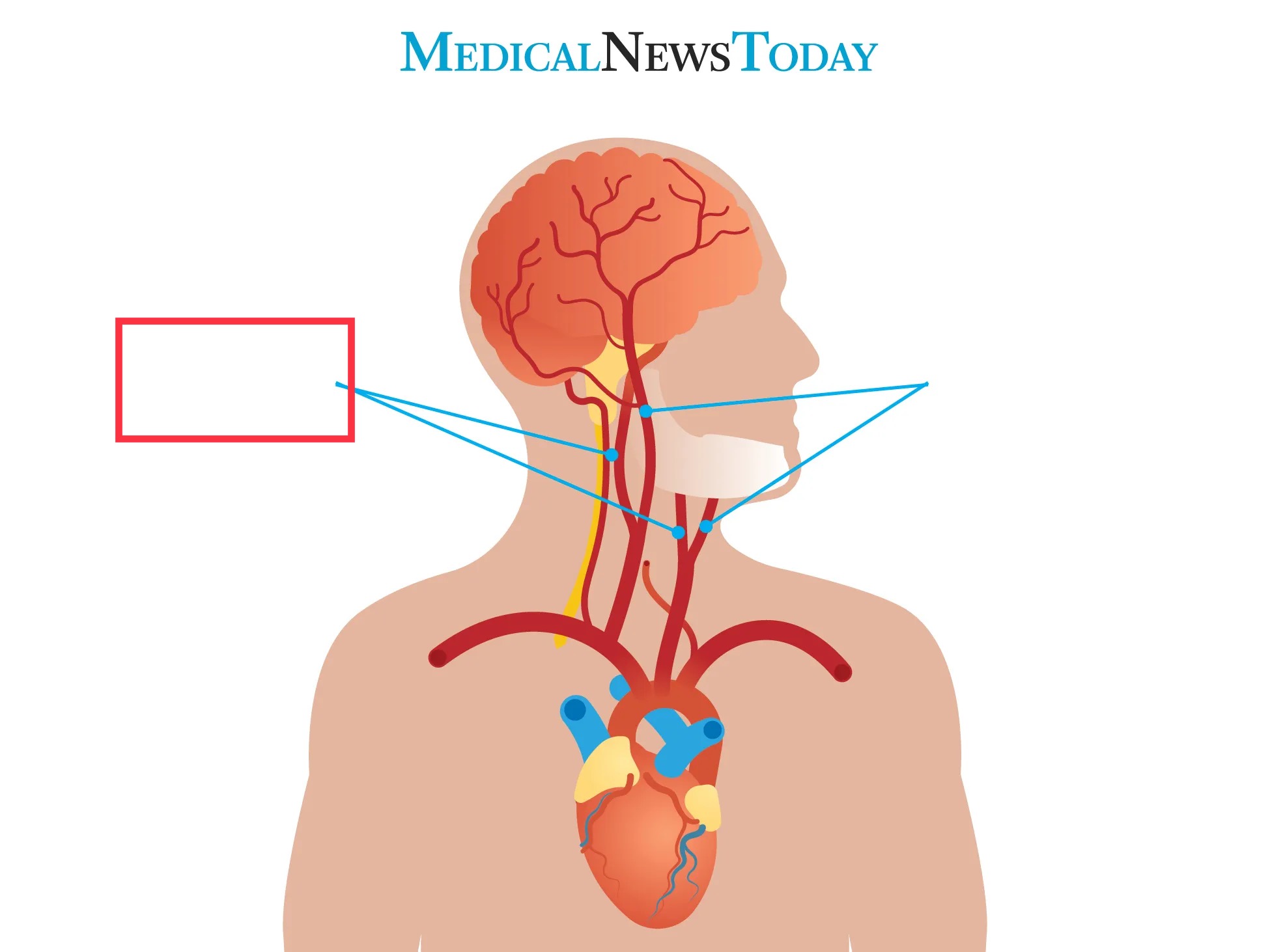 branch from the common carotid artery that enters the cranium and supplies blood to the brain