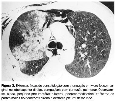 <p>CIR - diagnóstico, clínica e conduta?</p>