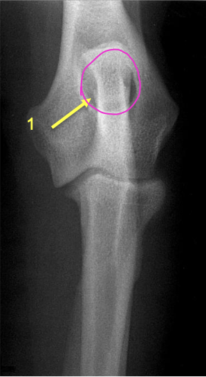 <p>what is the pink circling?</p>