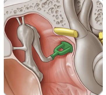 <p><span>Cabeza, cuello, dos brazos, base</span></p>