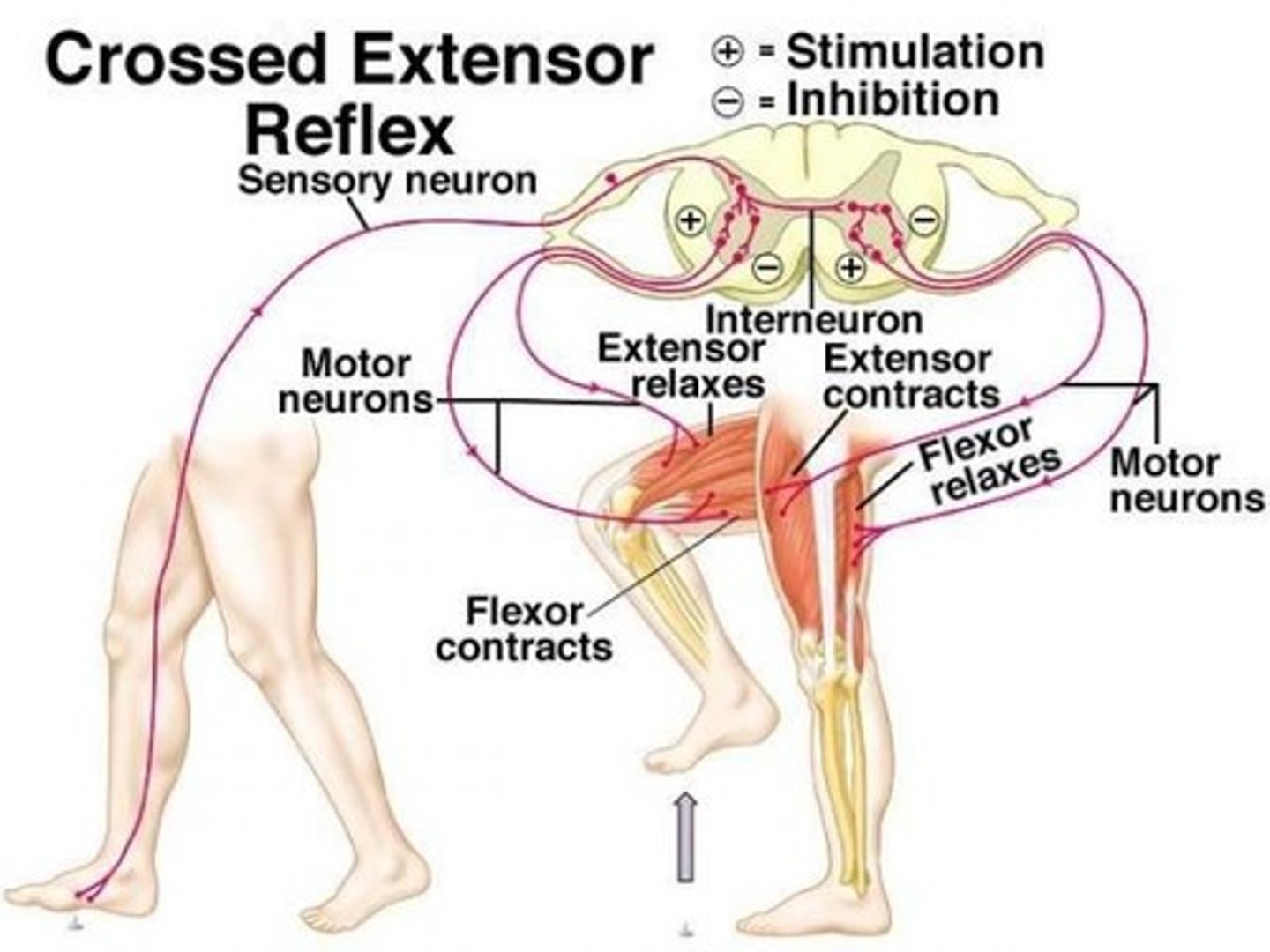 <p>-flexion of the injured limb (withdrawal from painful stimulus) &amp;<br>extension of the contralateral (opposite) limb to maintain balance &amp; posture<br>-can be artificially triggered by applying a painful stimulus to a limb</p>