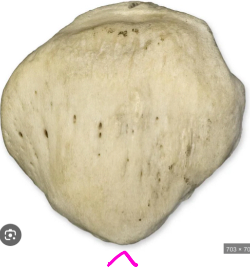 <p>What is the pink arrow pointing to?</p>