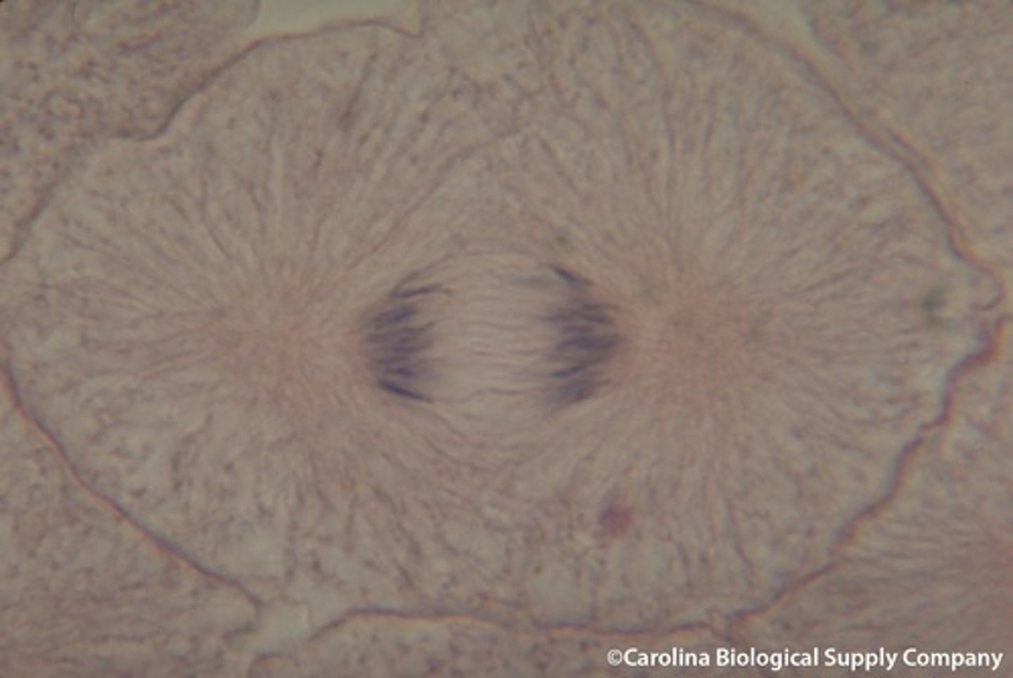 <p>Phase of mitosis in which the chromosomes separate and move to opposite ends of the cell</p>