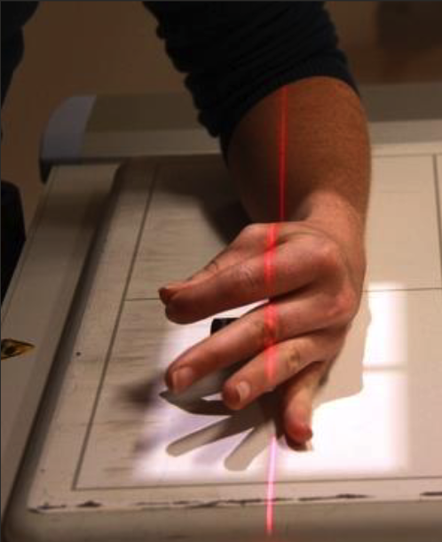 <ul><li><p>Hand perpendicular or IR, ‘ok sign’ or stacked/superimposed.</p></li><li><p>Fingers straight, supported by sponge.</p></li></ul><p></p>