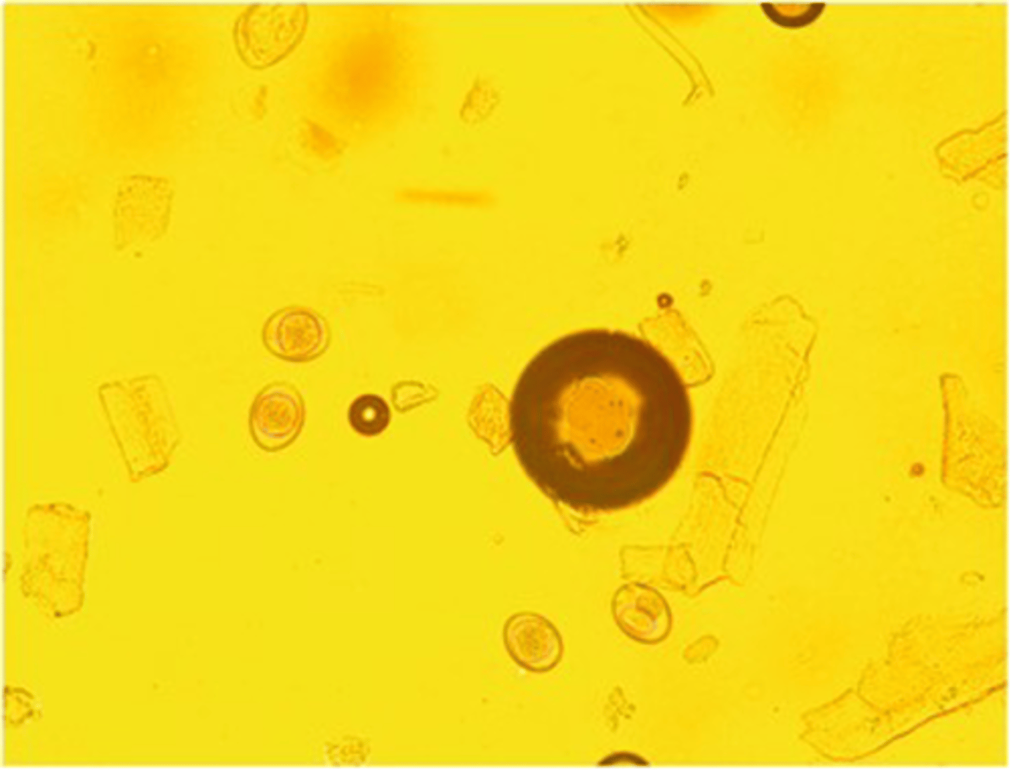 <p>These oocysts of a protozoan that infects dogs, cats, and pigs have several different species,</p><p>each having different sized oocysts. This picture shows two different sized oocysts. This</p><p>protozoan genus is:</p>