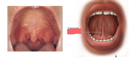 <ul><li><p>fold of tissue under tongue: restricts movement</p></li></ul><p></p>