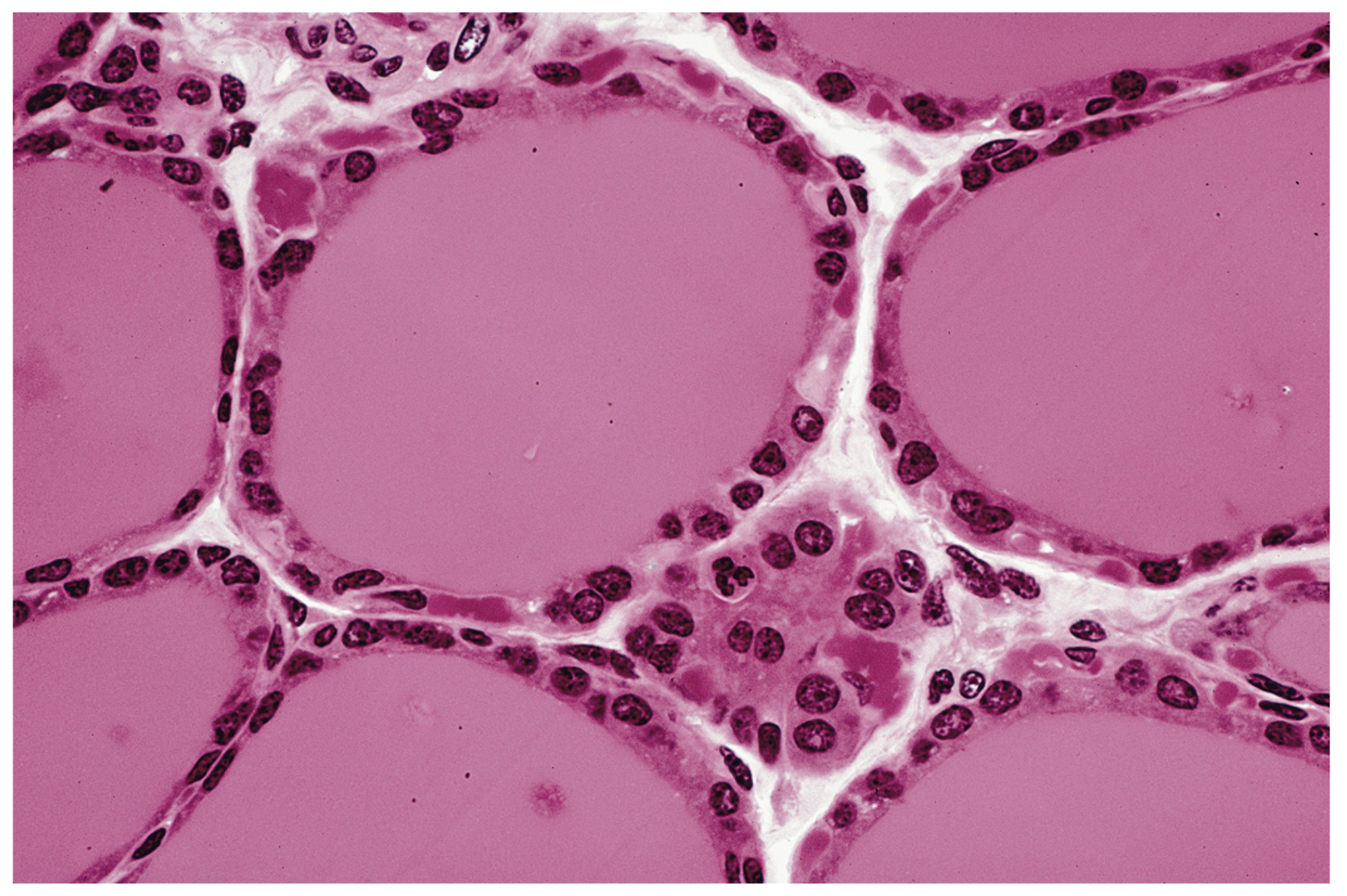 <p>Simple cuboidal epithelium.</p>