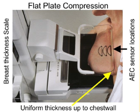 <p><span><span>•Major contribution is reshaping of the breast into a more uniform thickness spread over a slightly larger area;</span></span></p><p><span><span>•Uniform thickness reduced range of X-ray exposure to the receptor and loss of contrast due to latitude limitations;</span></span></p><p><span><span>•Spreading of breast tissue, especially thicker regions, reduced overlapping of objects &amp; structures that could interfere with visualisation;</span></span></p><p><span><span>•Especially significant for imaging tissues up to the chest wall.</span></span></p><p><span><span>•Display and measurement of thickness: exposure factor selection</span></span></p><p><span><span>•AEC sensor location: selection desired density</span></span></p><p></p>