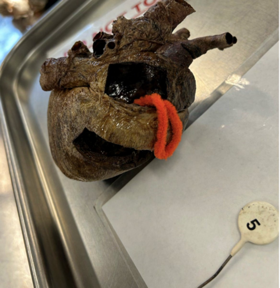 <p>ID the opening between the two chambers of the heart the pipe cleaner is in.</p>