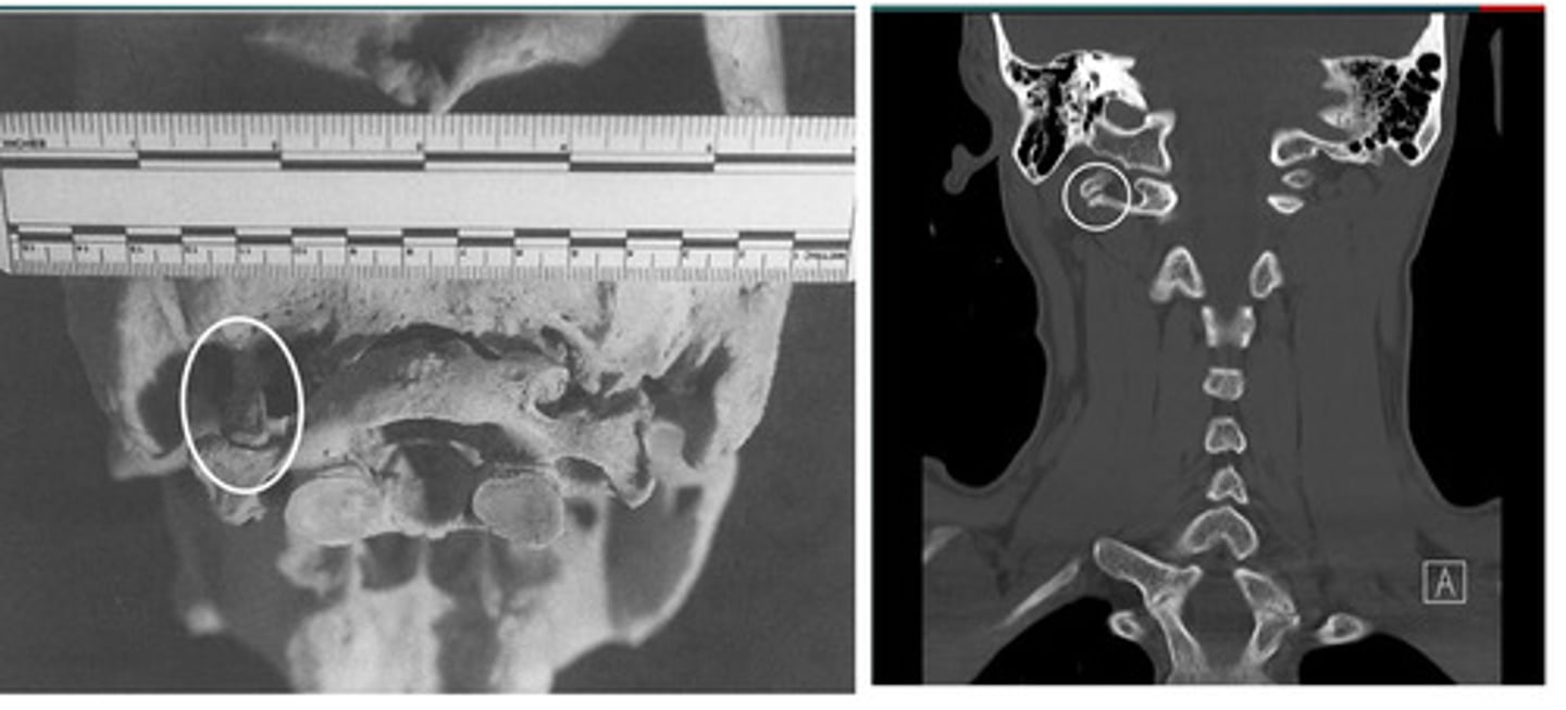 <p>What anomaly is this?</p>