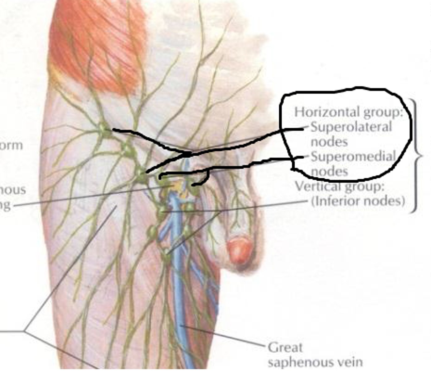 <p>Location: Superficial and lateral to the femoral vein</p><p>Description: Receives lymph from the abdominal wall and gluteal region</p>