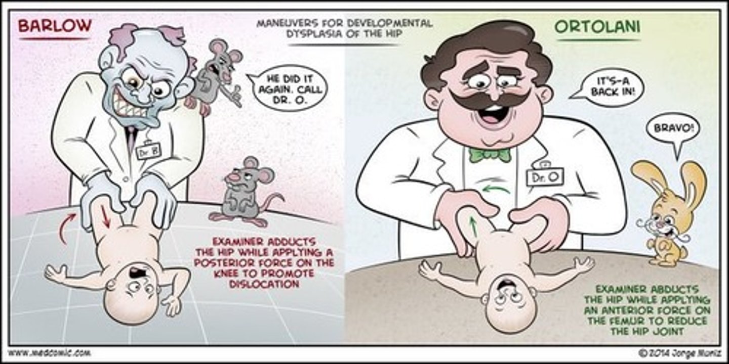 <p>the hip is abducted and gentle pressure isapplied to the proximal thigh from behind. Here, the examiner attemptsto relocate an already dislocated femoral head back into theacetabulum. If the joint is dislocated, a palpable "clunk" is noticed asthe head slides back into place.</p>