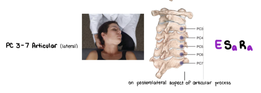 <p>E SARA </p><ul><li><p>Just go lateral of cervical.  Example C4, go a bit laterally on articular process to find</p></li></ul><p></p>