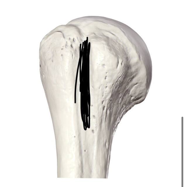 <p>Hoe heet dit botpunt?</p>