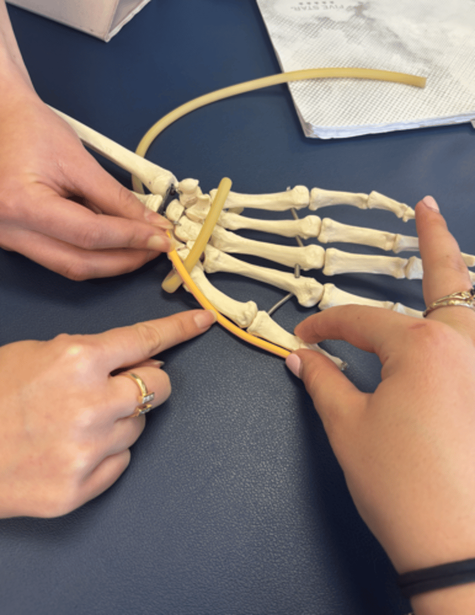 <p>What is this muscle?</p>