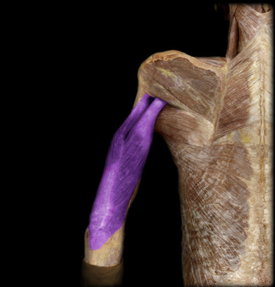 <p><em>table 1, radial n (C6-C8), elbow extension</em><br><em>I: olecranon process of elbow</em></p>