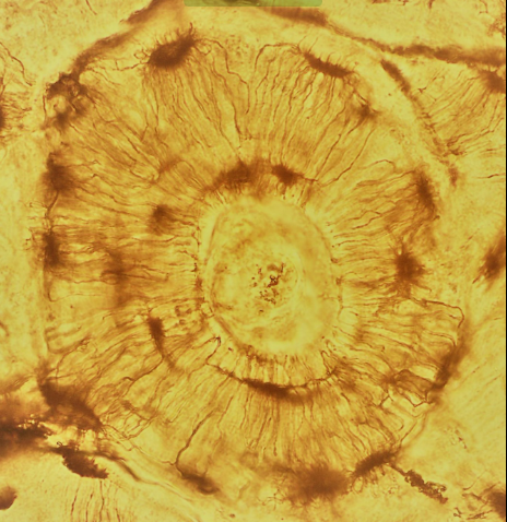 <p>A type of connective tissue characterized by a mineralized matrix, providing structural support and protection to the body while housing bone marrow for blood cell production. </p>