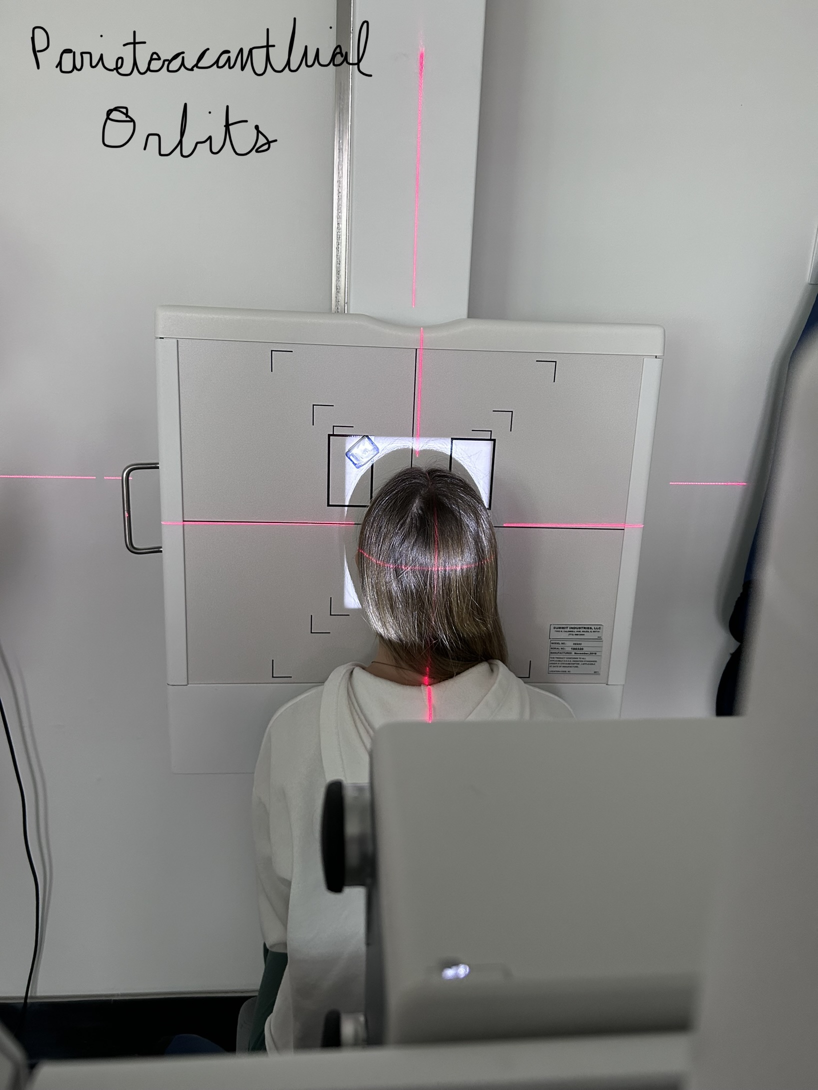 Parietoacanthial Orbits (Modified Waters)