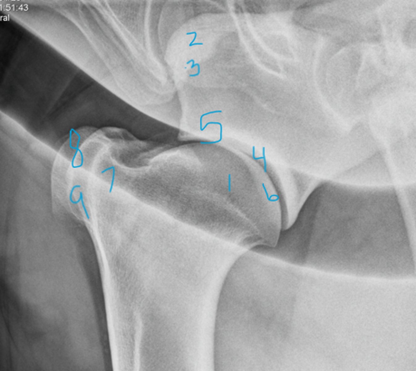 <p>Name the structures</p>