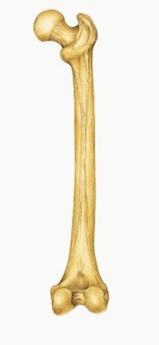 <p>ID bone</p>