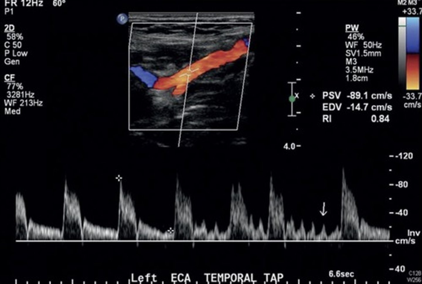 <p>High resistant</p>