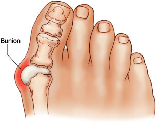 <p>big toe on tarsus with only 2 phalanges</p>